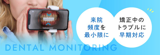 来院頻度を最小限に/矯正中のトラブル早期対応